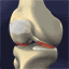 knee_damaged